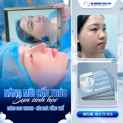 mũi cấu trúc (2).jpg